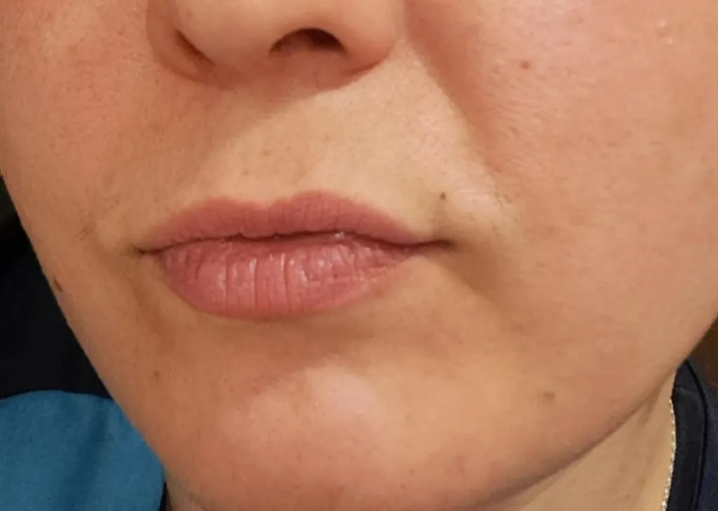 Клиентка на Габриела Карчина с перманентна бенка. Фото: Личен архив на Габриела Карчина