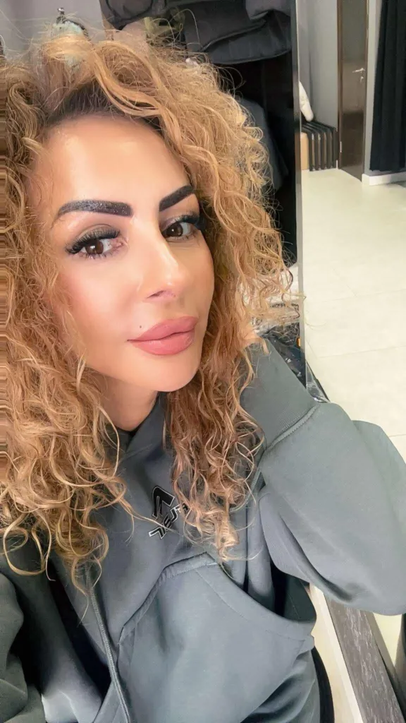 Клиентка на Габриела Карчина с перманентна бенка. Фото: Личен архив на Габриела Карчина