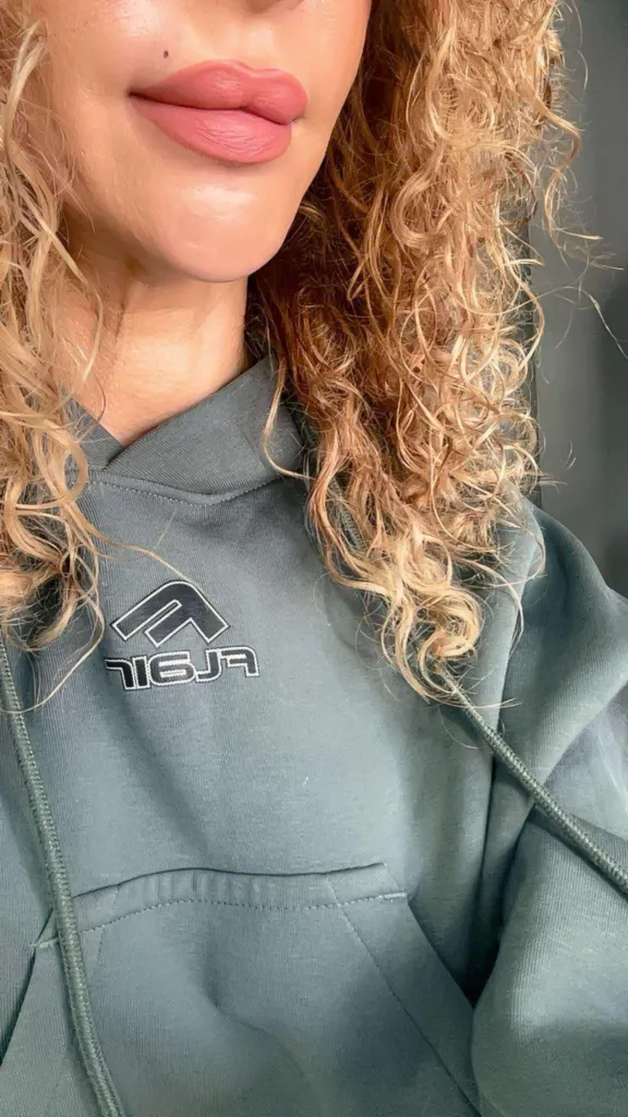 Клиентка на Габриела Карчина с перманентна бенка. Фото: Личен архив на Габриела Карчина